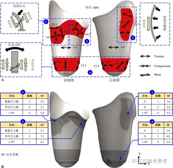 西交大：连续纤维增强复合材料康复辅具形性协同设计与3D打印(图3)