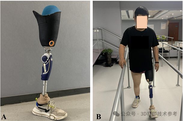 西交大：连续纤维增强复合材料康复辅具形性协同设计与3D打印(图4)